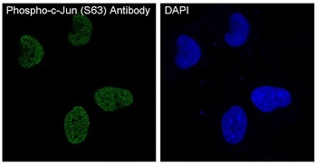 Anti-Phospho-c-Jun (S63) Rabbit Monoclonal Antibody