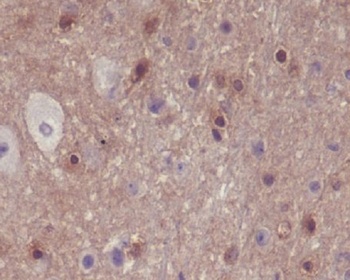 Phospho-PAK1/2/3 (S144+S141+S139) PAK3 Rabbit Monoclonal Antibody