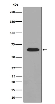 Phospho-PAK1/2/3 (S144+S141+S139) PAK3 Rabbit Monoclonal Antibody