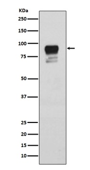 Phospho-Glycogen synthase 1 (S641) GYS1 Rabbit Monoclonal Antibody