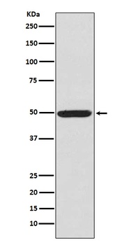 Phospho-PKA R2 (S99) PRKAR2A Rabbit Monoclonal Antibody