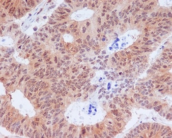 Phospho-EIF2S1 (S51) Rabbit Monoclonal Antibody
