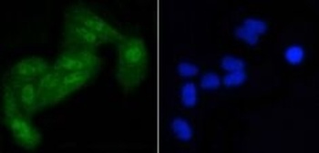 Phospho-EIF2S1 (S51) Rabbit Monoclonal Antibody