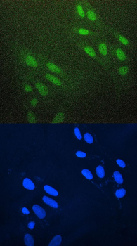 Anti-AREB6/ZEB1 Antibody