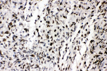 Anti-AREB6/ZEB1 Antibody