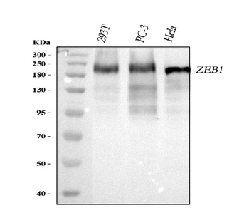 Anti-AREB6/ZEB1 Antibody