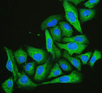 Anti-Cofilin 2/CFL2 Antibody (monoclonal, 8C13)