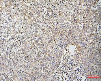 Anti-Cofilin 2/CFL2 Antibody (monoclonal, 8C13)
