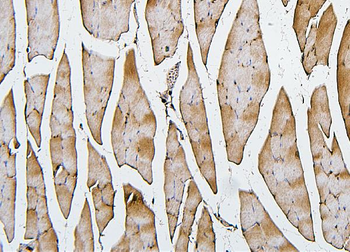 Anti-Cofilin 2/CFL2 Antibody (monoclonal, 8C13)