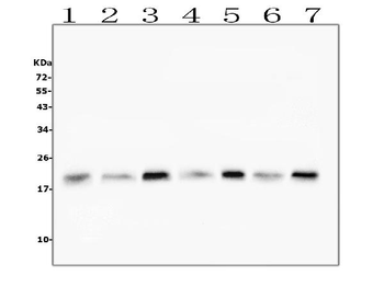 Anti-Cofilin 2/CFL2 Antibody (monoclonal, 8C13)