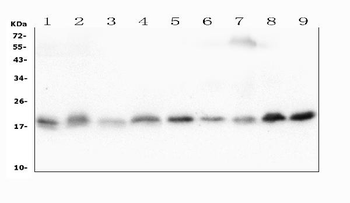 Anti-Cofilin 2/CFL2 Antibody (monoclonal, 8C13)