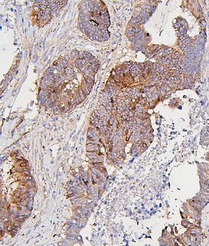 Anti-CDK1 Antibody (monoclonal, 2G11)