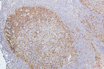 Anti-CDK1 Antibody (monoclonal, 2G11)
