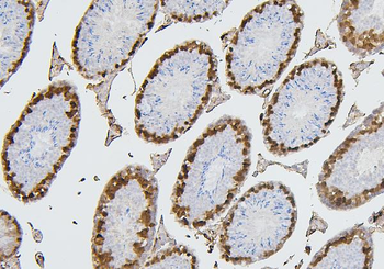 Anti-CDK1 Antibody (monoclonal, 2G11)