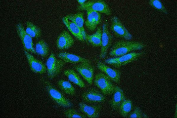 Anti-Hsp27/HSPB1 Antibody (monoclonal, 3H3)