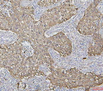 Anti-Hsp27/HSPB1 Antibody (monoclonal, 3H3)