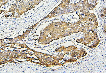 Anti-Hsp27/HSPB1 Antibody (monoclonal, 3H3)