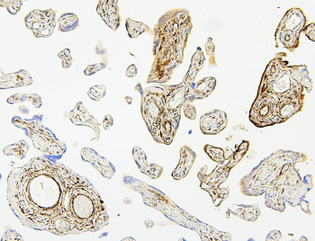 Anti-Hsp27/HSPB1 Antibody (monoclonal, 3H3)