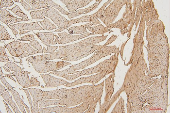 Anti-PPCS Antibody (monoclonal, 7G13)