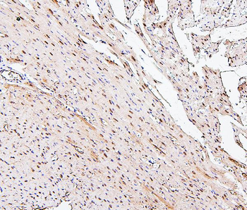 Anti-PPCS Antibody (monoclonal, 7G13)