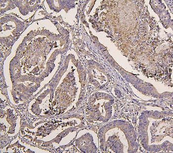 Anti-IRS1 Antibody (monoclonal, 10I3)