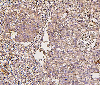 Anti-IRS1 Antibody (monoclonal, 10I3)
