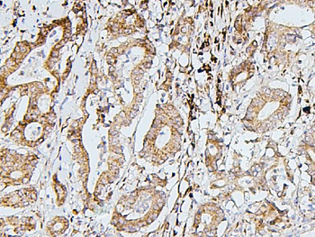 Anti-SDHB Antibody (monoclonal, 2I3)