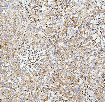 Anti-SDHB Antibody (monoclonal, 2I3)