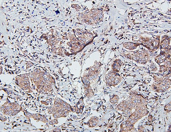 Anti-SDHB Antibody (monoclonal, 2I3)