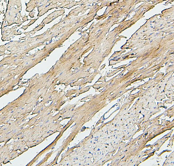 Anti-SDHB Antibody (monoclonal, 2I3)