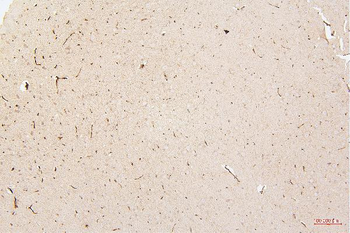 Anti-HMGB1 Antibody (monoclonal, 5H3)