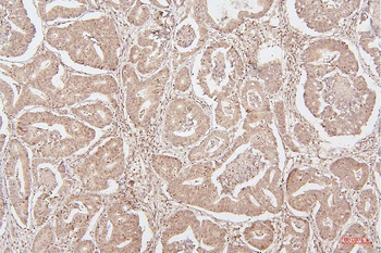 Anti-HMGB1 Antibody (monoclonal, 5H3)
