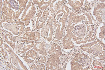 Anti-HMGB1 Antibody (monoclonal, 5H3)