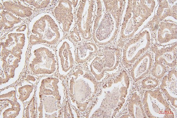 Anti-HMGB1 Antibody (monoclonal, 5H3)