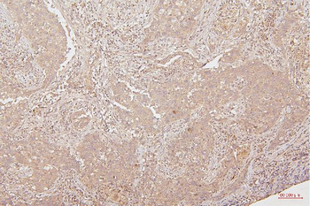 Anti-HMGB1 Antibody (monoclonal, 5H3)