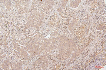 Anti-HMGB1 Antibody (monoclonal, 5H3)