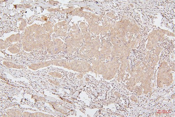 Anti-HMGB1 Antibody (monoclonal, 5H3)