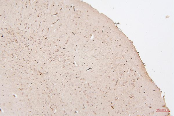 Anti-HMGB1 Antibody (monoclonal, 5H3)
