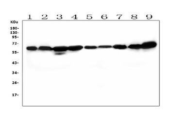 SQSTM1/p62 Antibody (monoclonal, 3H11)