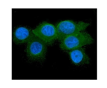 Anti-RAB27A Antibody (monoclonal, 2F5)