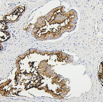 Anti-RAB27A Antibody (monoclonal, 2F5)