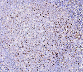 Anti-RAB27A Antibody (monoclonal, 2F5)