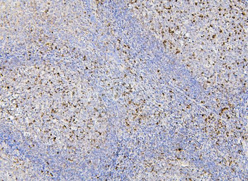Anti-RAB27A Antibody (monoclonal, 2F5)