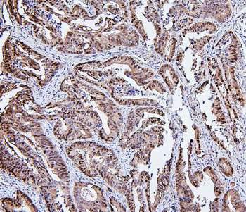 Anti-Hsp105/HSPH1 Antibody (monoclonal, 3D10)