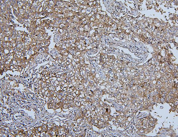 Anti-Hsp105/HSPH1 Antibody (monoclonal, 3D10)