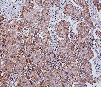 Anti-Hsp105/HSPH1 Antibody (monoclonal, 3D10)