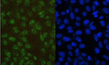 PAX5 Antibody (monoclonal, 6I4)