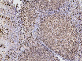 Anti-PAX5 Antibody (monoclonal, 6I4)