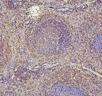 Anti-PAX5 Antibody (monoclonal, 6I4)