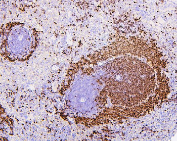 Anti-PAX5 Antibody (monoclonal, 6I4)